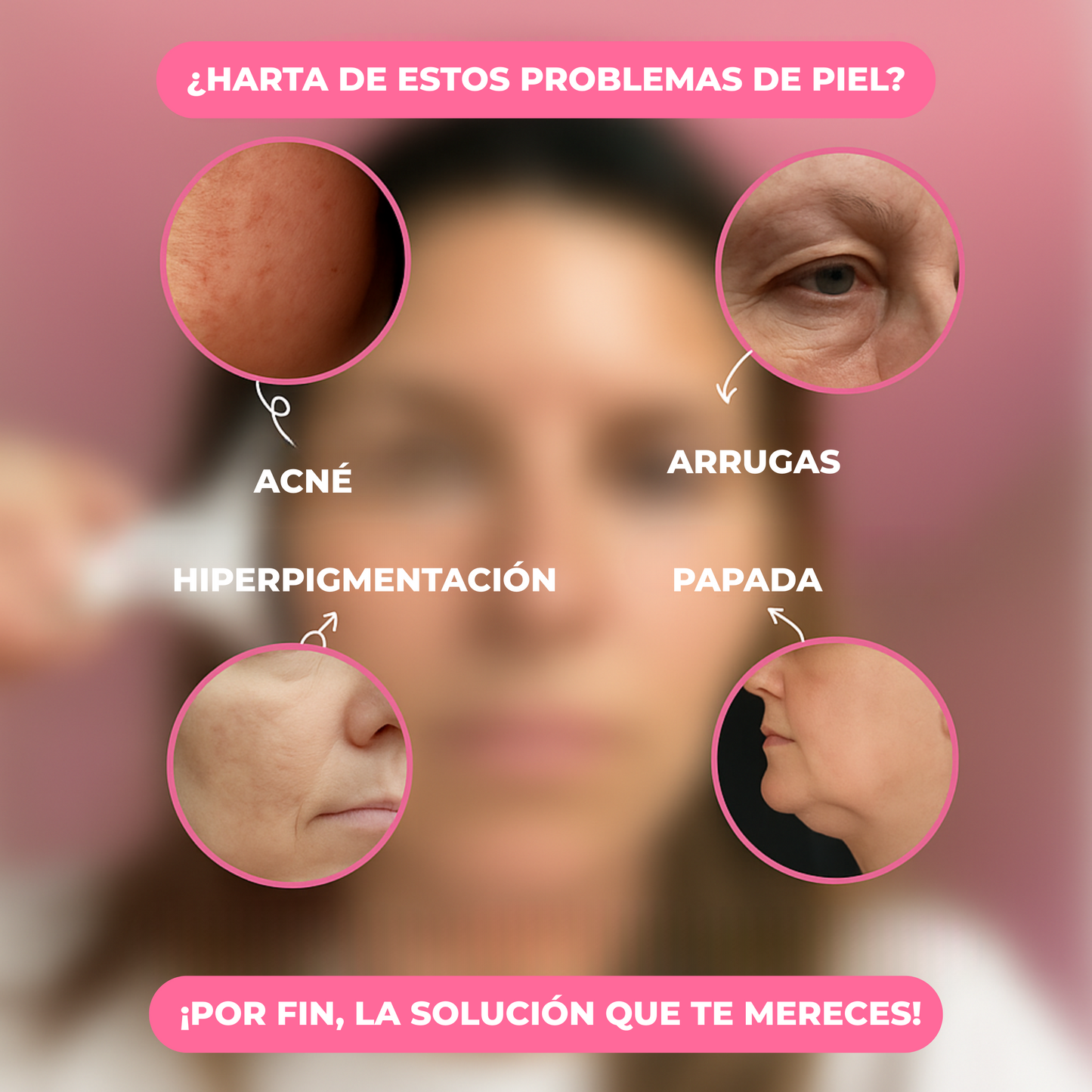 Lifting facial 5 en 1
